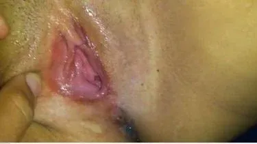 Bangali Sex Teenager, eighteen, sucking her virginal pussy
